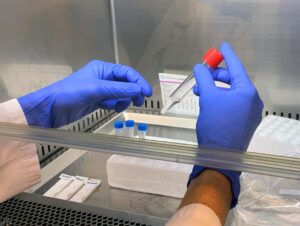 Los hospitales Quirónsalud de Andalucía incorporan la PCR con muestra en saliva para detección de Covid-19. / Foto: Quirónsalud. / Europa Press.