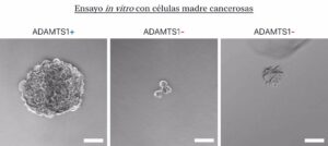 Demuestran el papel de una proteína en el desarrollo de uno de los melanomas más raros y agresivos