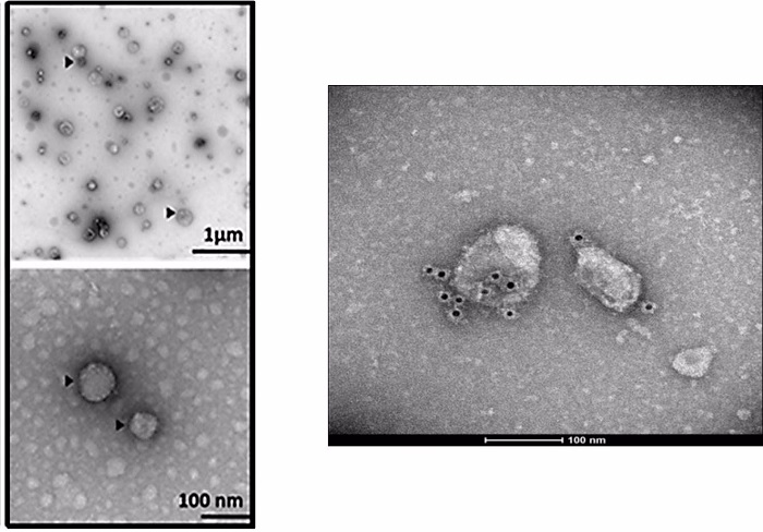 Identifican biomarcadores para diagnóstico de pacientes con melanoma maligno