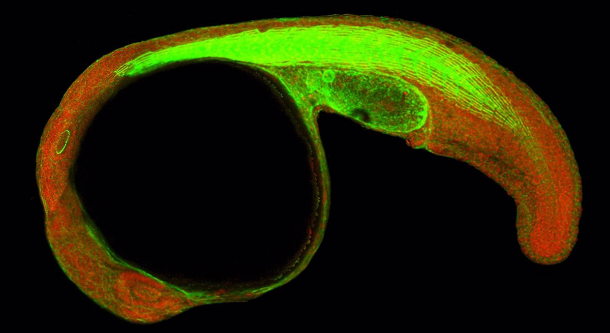 Vinculan una proteína con la regulación de los genes responsables del desarrollo embrionario